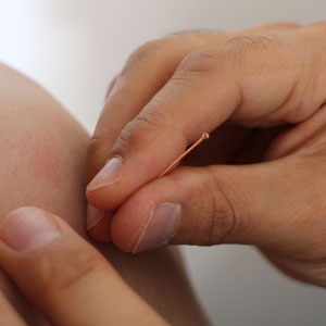 Acupuncture in Exeter and North Tawton